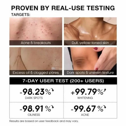 TeaShell Niacinamide Skin Brightening Soap | Face & Body Brightening Bar with Niacinamide, Alpha Arbutin & Tranexamic Acid | Deep Cleansing Formula | For Men & Women | 100g